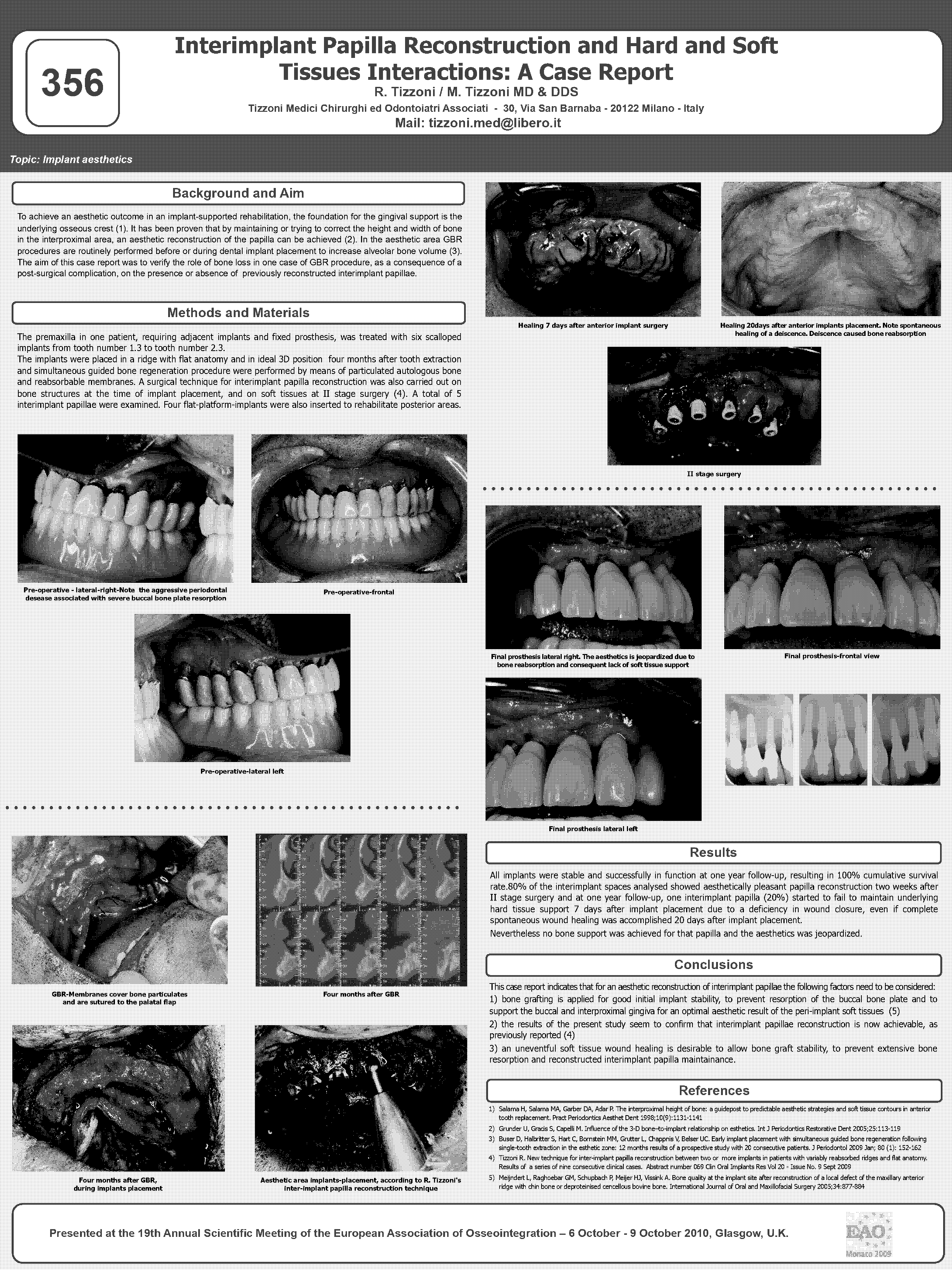 papilla reconstruction case report