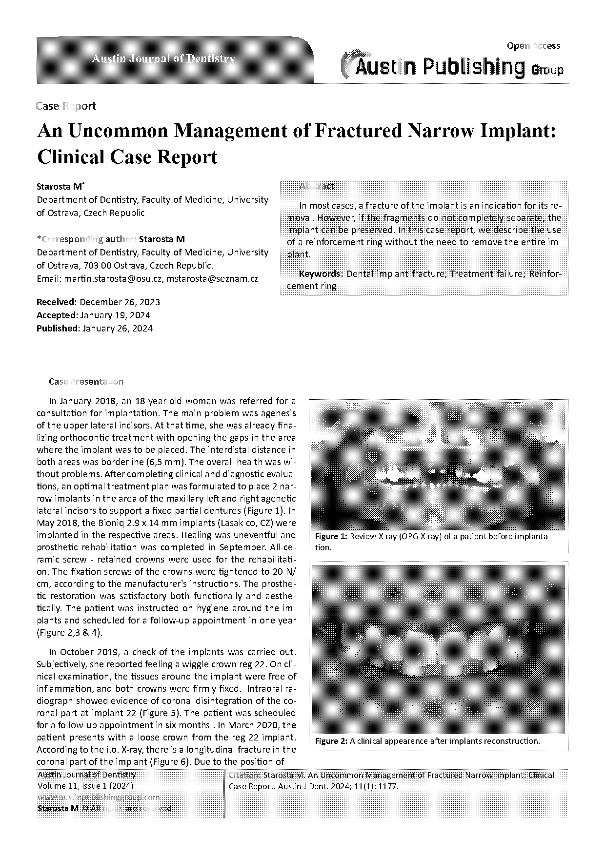 management of fractured dental implants a case report